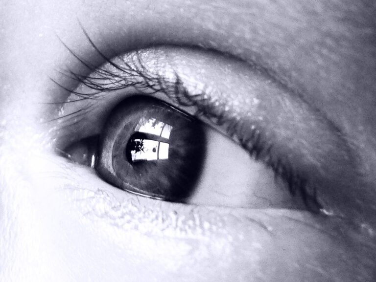 oog